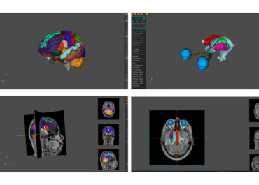 AnaVu: IIIT-Hyderabad’s 3D Anatomy Visualization Platform Transforming Medical Education